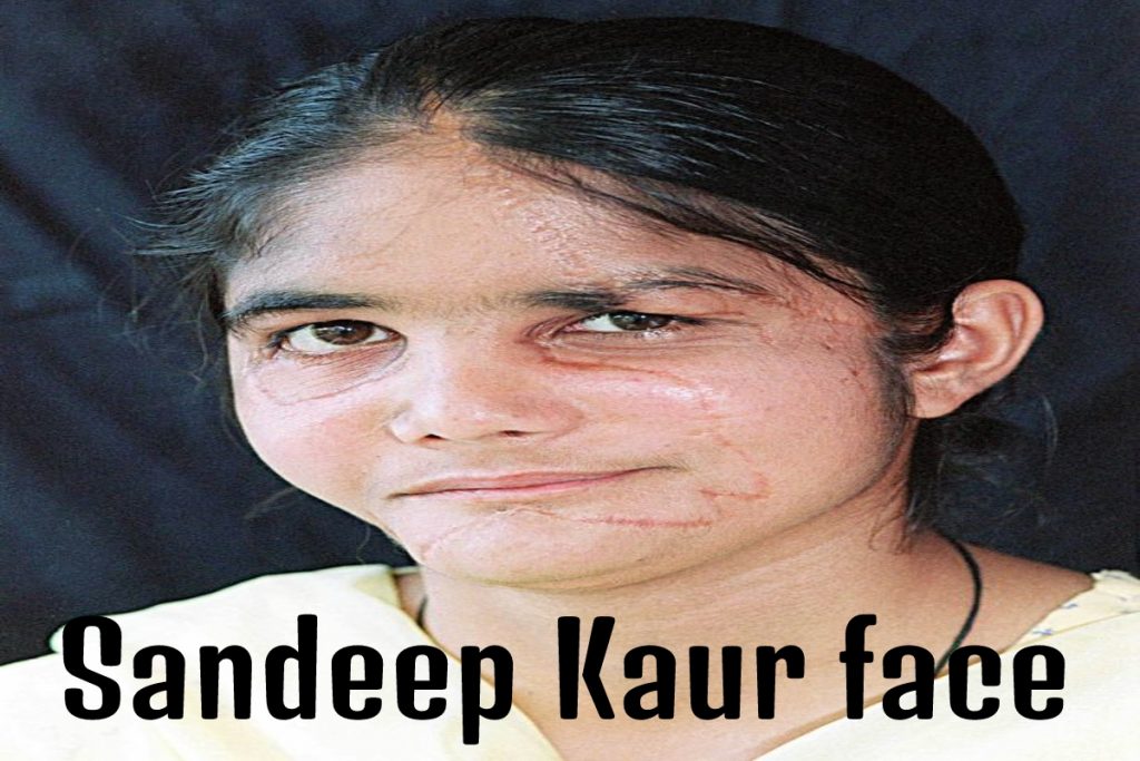 Sandeep Kaur face